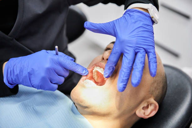 Best Emergency Dental Care for Broken or Chipped Teeth in Sandy Valley, NV
